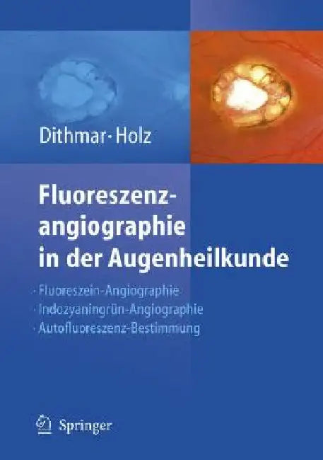 Buy Fluoreszenzangiographie in Der Augenheilkunde (English, Stefan Dithmar | Frank G. Holz) — BookShops.in