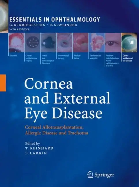 Cornea and External Eye Disease (English, Thomas Reinhard | Frank Larkin)