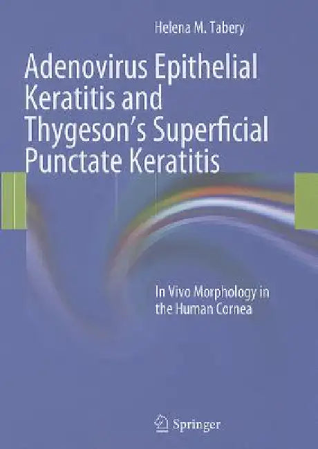 Buy Adenovirus Epithelial Keratitis and Thygeson's Superficial Punctate Keratitis (English, Helena M. Tabery) — BookShops.in