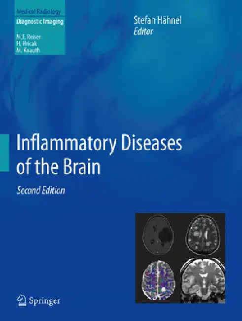Buy Inflammatory Diseases of the Brain (English, Stefan Hähnel) — BookShops.in