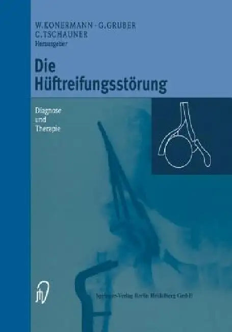 Die Hüftreifungsstörung (English, Werner Konermann | Gerd Gruber | Christian Tschauner)