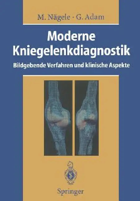 Buy Moderne Kniegelenkdiagnostik | by Matthias Nägele | R. W. Günther | Gerhard Adam | Springer | by Matthias Nägele | R. W. Günther | Gerhard Adam | Springer | by Matthias Nägele | R. W. Günther | Gerhard Adam | Springer | by Matthias Nägele | R. W. Günther | Gerhard Adam | Springer | by Matthias Nägele | R. W. Günther | Gerhard Adam | Springer | by Matthias Nägele | R. W. Günther | Gerhard Adam | Springer | by Matthias Nägele | R. W. Günther | Gerhard Adam | Springer | by Matthias Nägele | R. W. G — BookShops.in