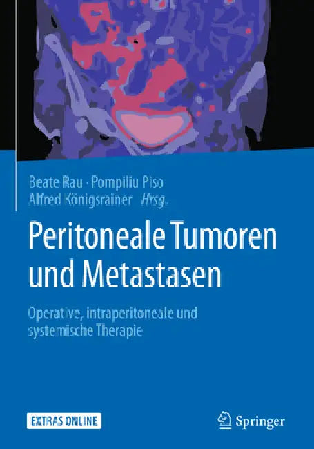 Peritoneale Tumoren Und Metastasen (English, Beate Rau | Pompiliu Piso | Alfred Königsrainer)