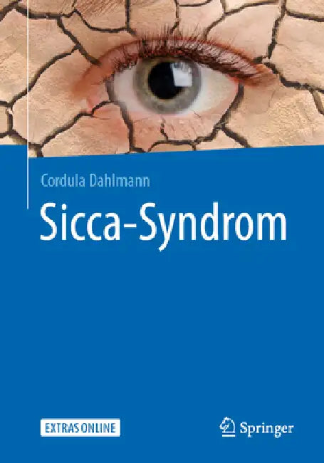 Buy Sicca-Syndrom (English, Cordula Dahlmann) — BookShops.in