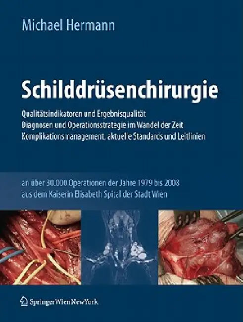 Buy Schilddrüsenchirurgie - Qualitätsindikatoren Und Ergebnisqualität, Diagnosen Und Operationsstrategie (English, Michael Hermann) — BookShops.in