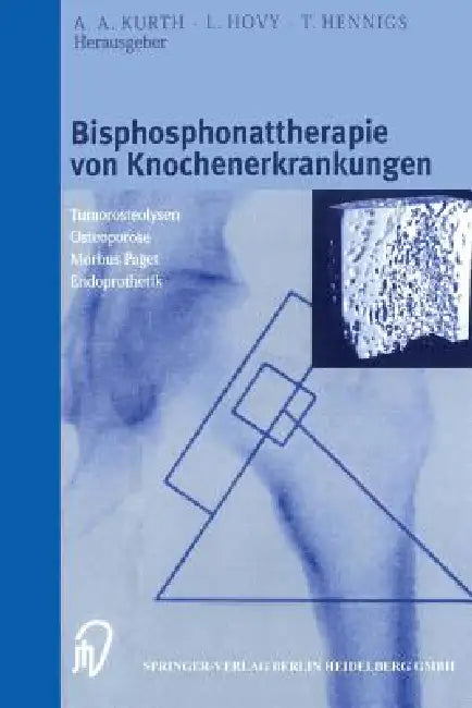Bisphosphonattherapie Von Knochenerkrankungen (English, A. A. Kurth | L. Hovy | T. Hennigs)