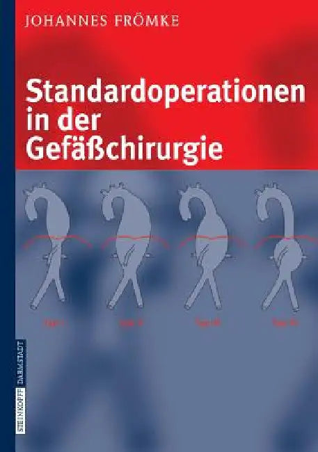 Standardoperationen in Der Gefäßchirurgie (English, Johannes Frömke)