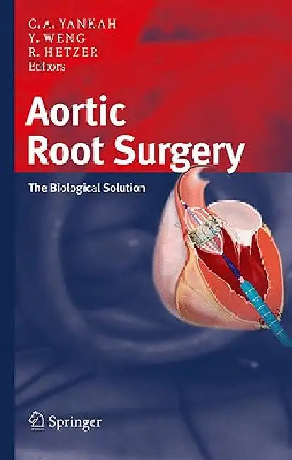 Buy Aortic Root Surgery | by Charles Abraham Yankah | Yu-Guo Weng | Roland Hetzer | Steinkopff | by Charles Abraham Yankah | Yu-Guo Weng | Roland Hetzer | Steinkopff | by Charles Abraham Yankah | Yu-Guo Weng | Roland Hetzer | Steinkopff | by Charles Abraham Yankah | Yu-Guo Weng | Roland Hetzer | Steinkopff | by Charles Abraham Yankah | Yu-Guo Weng | Roland Hetzer | Steinkopff | by Charles Abraham Yankah | Yu-Guo Weng | Roland Hetzer | Steinkopff | by Charles Abraham Yankah | Yu-Guo Weng | Roland Het — BookShops.in