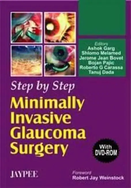 Buy Step By Step Minimally Invasive Glaucoma Surgery With Dvd-Rom | by Ashok Garg | Jaypee Brothers Medical Publishers | by Ashok Garg | Jaypee Brothers Medical Publishers | by Ashok Garg | Jaypee Brothers Medical Publishers | by Ashok Garg | Jaypee Brothers Medical Publishers | by Ashok Garg | Jaypee Brothers Medical Publishers | by Ashok Garg | Jaypee Brothers Medical Publishers | by Ashok Garg | Jaypee Brothers Medical Publishers | by Ashok Garg | Jaypee Brothers Medical Publishers | by Ashok Gar — BookShops.in