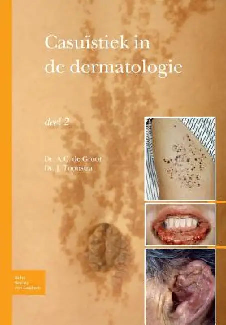 Buy Casuïstiek in de Dermatologie - Deel 2 (English, Johan Toonstra) — BookShops.in
