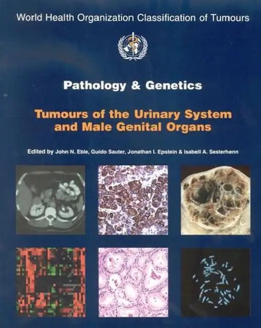 Pathology & Genetics Tumours Of The Urinary System And Male Genital Organs Who Classification Of Tum (English, Eble)