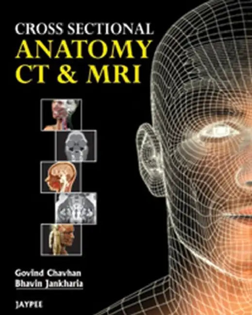 Buy Cross Sectional Anatomy Ct And Mri | by Govind B Chavhan | Jaypee Brothers Medical Publishers | by Govind B Chavhan | Jaypee Brothers Medical Publishers | by Govind B Chavhan | Jaypee Brothers Medical Publishers | by Govind B Chavhan | Jaypee Brothers Medical Publishers | by Govind B Chavhan | Jaypee Brothers Medical Publishers | by Govind B Chavhan | Jaypee Brothers Medical Publishers | by Govind B Chavhan | Jaypee Brothers Medical Publishers | by Govind B Chavhan | Jaypee Brothers Medical Publ — BookShops.in