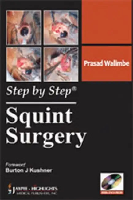 Step By Step Squint Surgery (English, Prasad Walimbe)