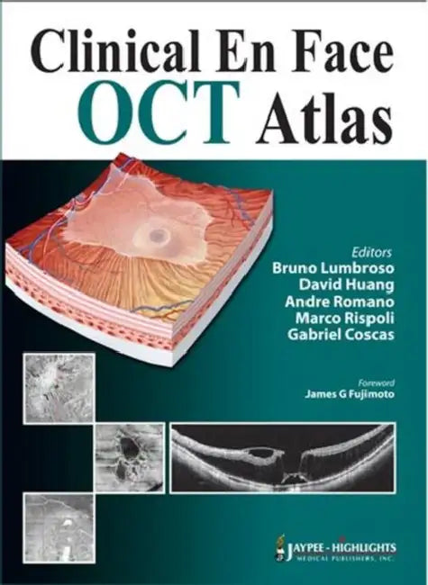 Buy Clinical En Face Oct Atlas | by Bruno Lumbroso | David Huang | Andre Romano | Jaypee Brothers Medical Publishers | by Bruno Lumbroso | David Huang | Andre Romano | Jaypee Brothers Medical Publishers | by Bruno Lumbroso | David Huang | Andre Romano | Jaypee Brothers Medical Publishers | by Bruno Lumbroso | David Huang | Andre Romano | Jaypee Brothers Medical Publishers | by Bruno Lumbroso | David Huang | Andre Romano | Jaypee Brothers Medical Publishers | by Bruno Lumbroso | David Huang | Andre R — BookShops.in