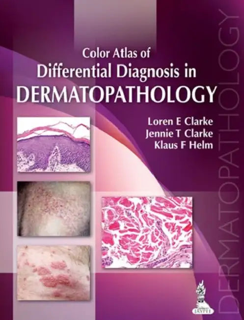 Buy Color Atlas Of Differential Diagnosis In Dermatopathology (English, Loren E Clarke) — BookShops.in