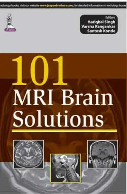 101 Mri Brain Solutions (English, Hariqbal Singh)